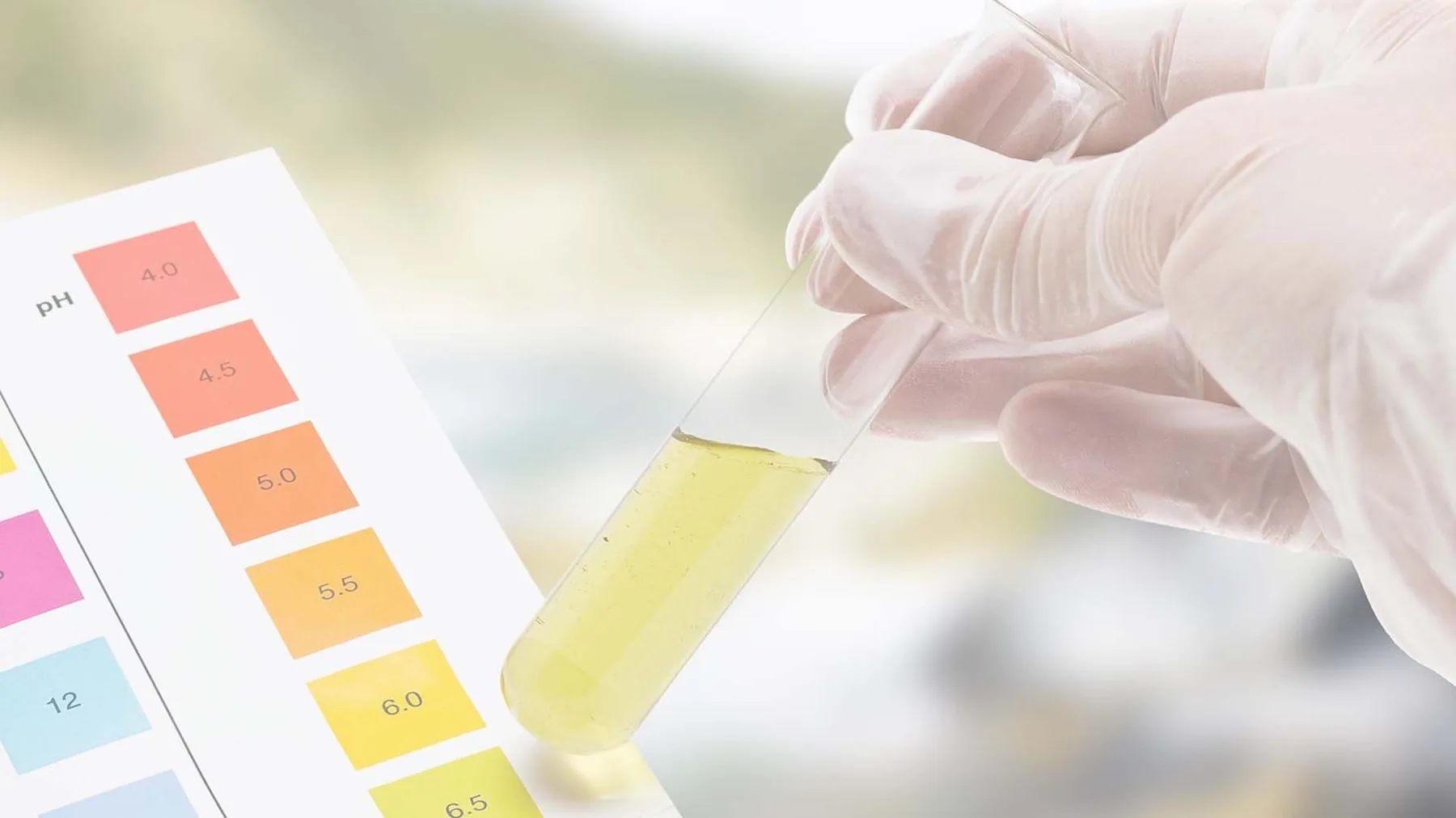 Urinanalyse