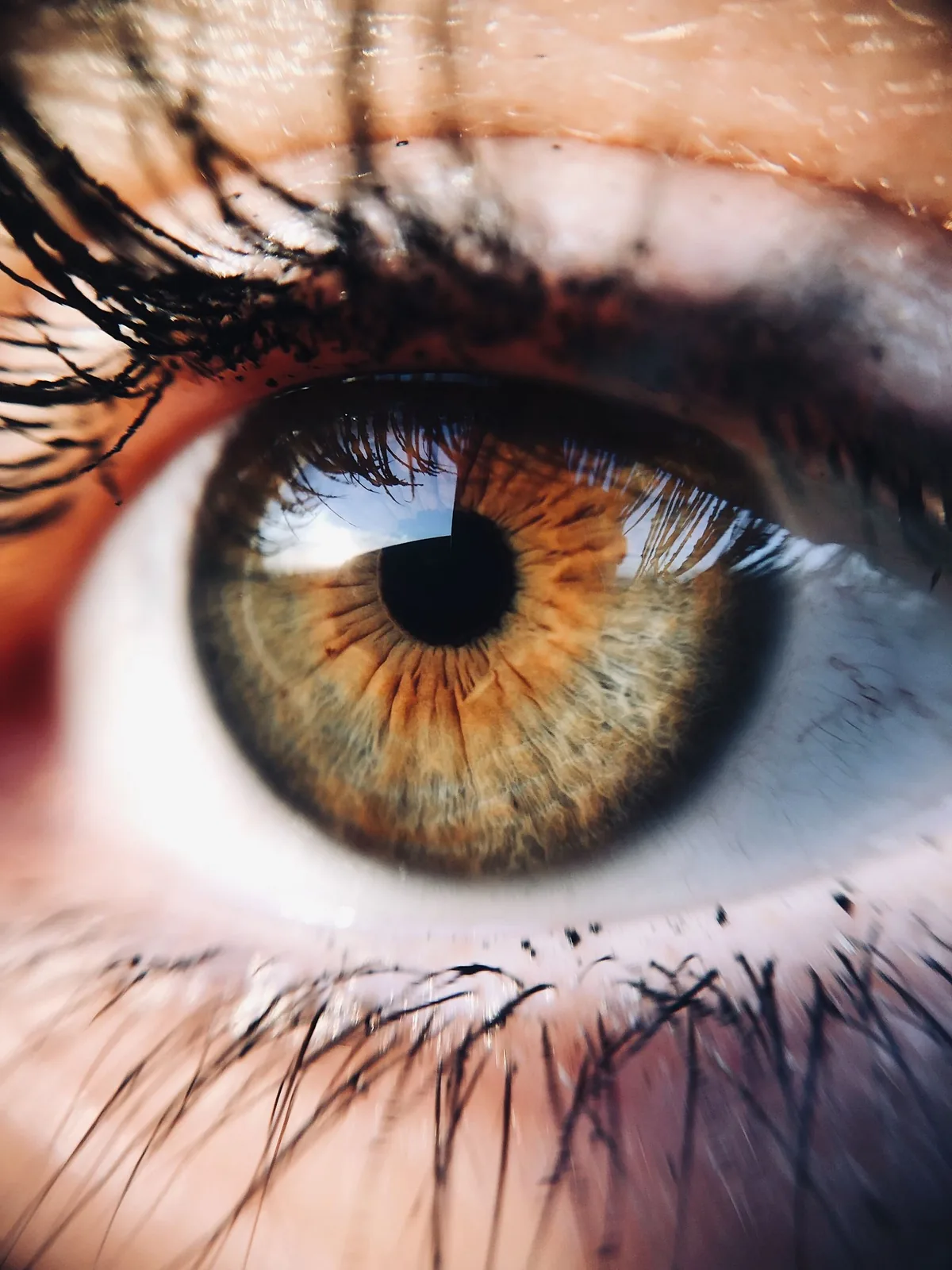 Iris-Augendiagnose